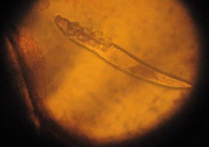 Visualisation d'un Demodex (parasite des follicules pileux)